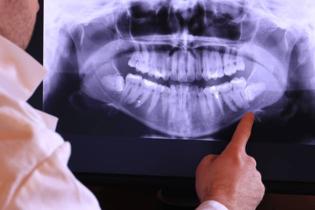 Best Weekend Emergency Dentist in Lisbon, ND